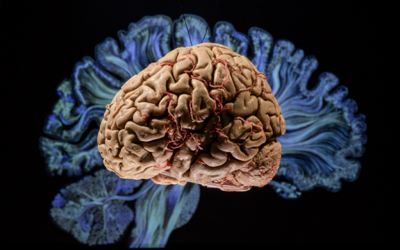 Exposição Cérebro – mais vasto que o céu